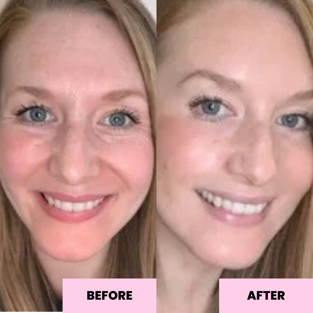 Anti-Oxidant Face Balm