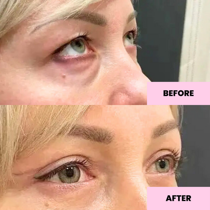 Anti-Oxidant Face Balm