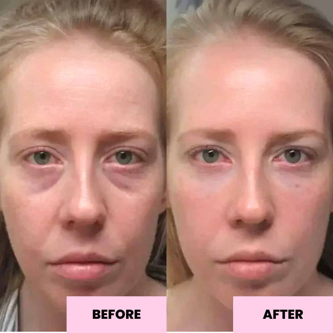 Retinol Balm & Anti-Oxidant Balm Bundle