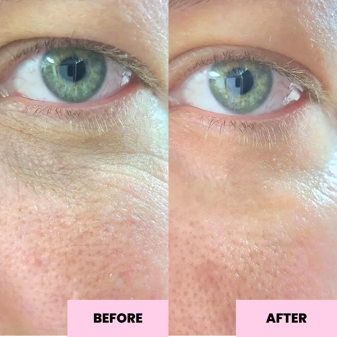 Retinol Eye Balm before and after 1