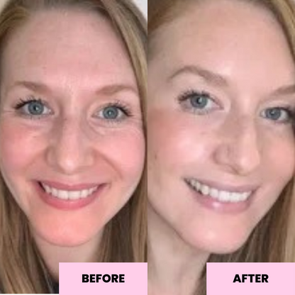 Anti-Oxidant Face Balm