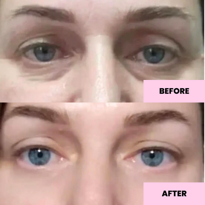 Retinol Eye Balm before and after 1