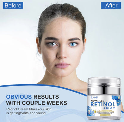 Retinol & Hyaluronic Acid Cream