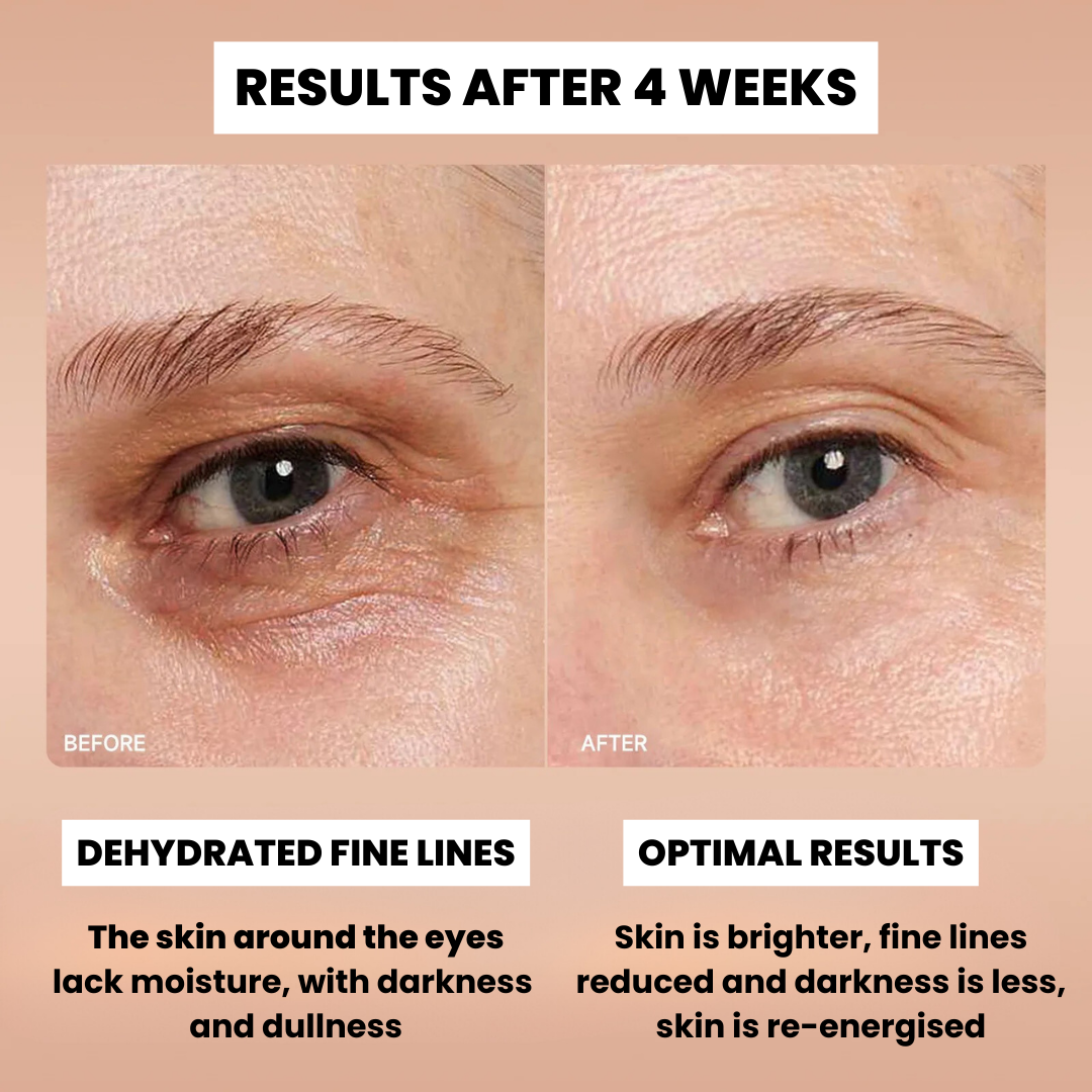 Retinol Eye Balm before and after