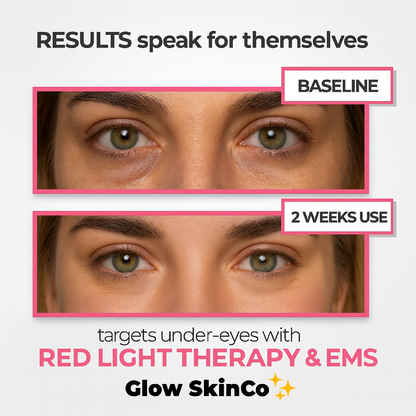 GlowEyes™ - Under-Eye Red Light Therapy