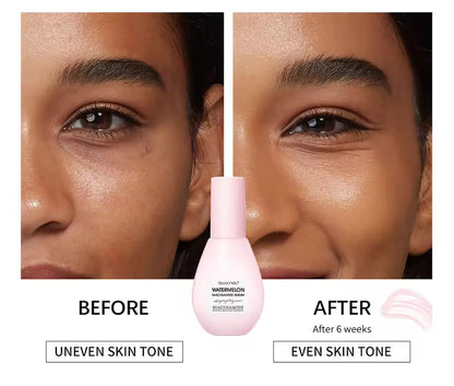 Glow Watermelon Niacinamide Dew Drops Serum 75ml