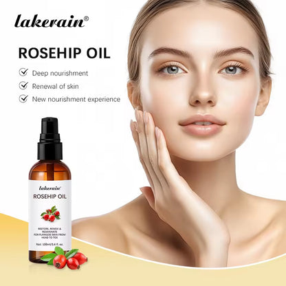 Rose Hip Oil 100Ml
