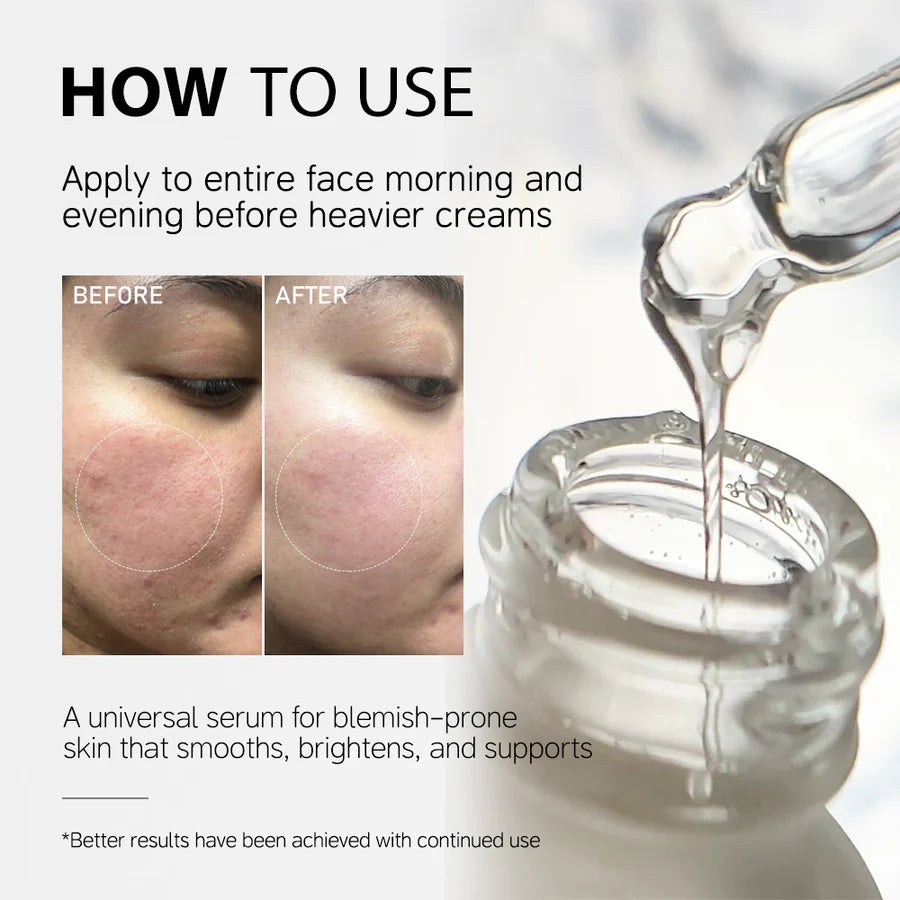 Niacinamide 10% Zinc 1% Serum