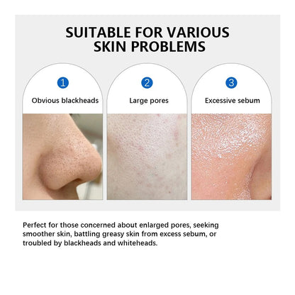 Zero Pore Toner Pads